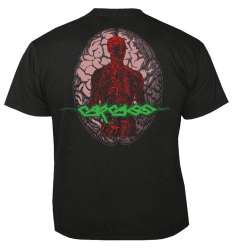 Camiseta CARCASS - Dead Body 2